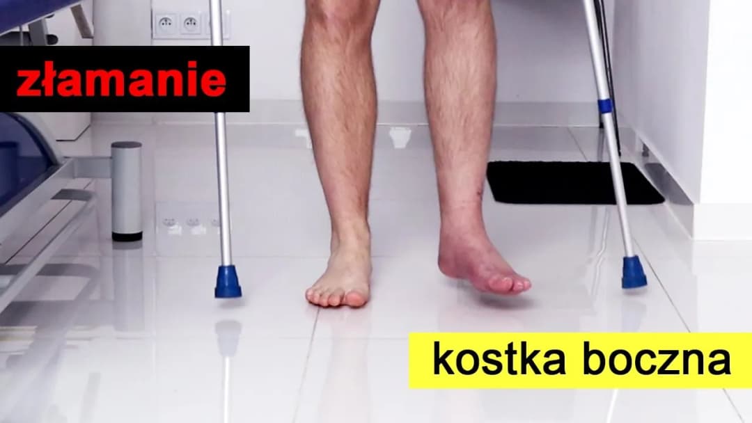 Jak ćwiczyć nogę po zdjęciu gipsu, aby uniknąć bólu i szybkiej rehabilitacji Jak ćwiczyć nogę po zdjęciu gipsu, aby uniknąć bólu i szybkiej rehabilitacji